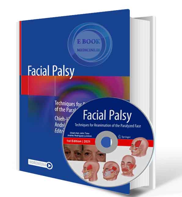 دانلود کتاب Facial Palsy: Techniques for Reanimation of the Paralyzed Face  2021 (ORIGINAL PDF+video)  